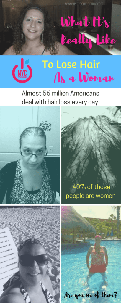 What Its Really Like to Lose Your Hair as a Woman: Almost 56 million Americans deal with hair loss every day and 40% of those people are women. Are you one of them? Follow my PRP Hair Treatment Journey for more hair and get all the details on how #hairloss has affected my life and how #PRPHairRepair has given me new hope. #spon