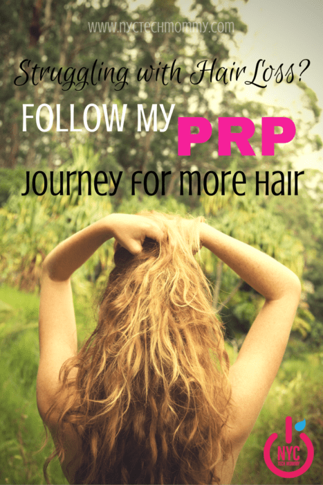 Almost 56 million Americans deal with hair loss every day and 40% of those people are women. Are you one of them? Follow my PRP Hair Treatment Journey for more hair and get all the details on hair repair and growth. #PRPHairRepair #HairLoss #HairGrowth #HairFriday
